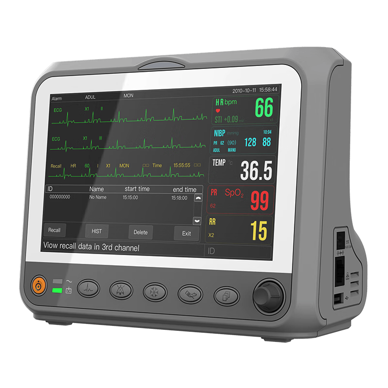 contec心电图机怎么用乐普多参数监护仪使用体验：比传统方式好在哪？_https://www.jmylbn.com_新闻资讯_第1张