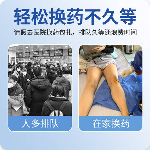 换药包里面有什么蓝洛保健器具使用体验：比传统换药方式好在哪？_https://www.jmylbn.com_新闻资讯_第1张