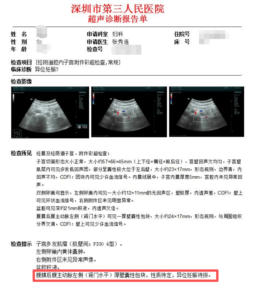 女子怀孕照B超却怎么也找不到“宝宝”！一查惊了