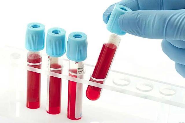 不吃他汀人群，血脂过低或增加脑出血、癌症风险！50万人研究来了