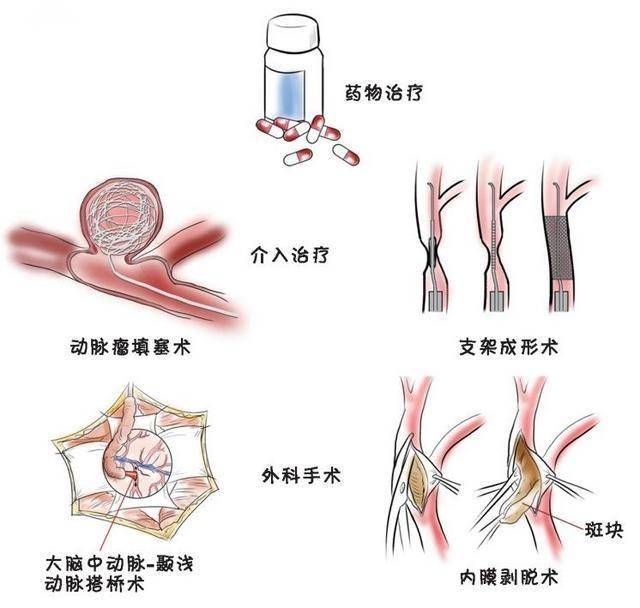 文章配图-1