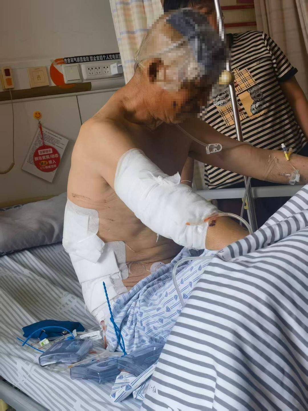 黑龙江一村民遭黑熊袭击全身多处受伤，手肘塞熊嘴惊险逃生！村干部：相关补偿正在办理